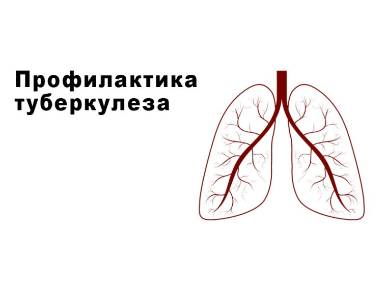 Профилактика туберкулёза. Профилактика туберкулёза.